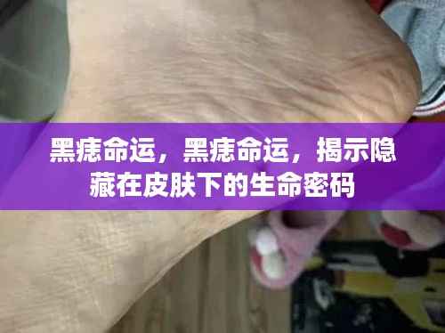 皮肤下的秘密,黑痣命运揭示生命密码探寻之旅