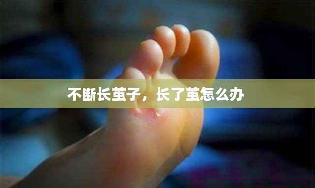 不断长茧子,长了茧怎么办